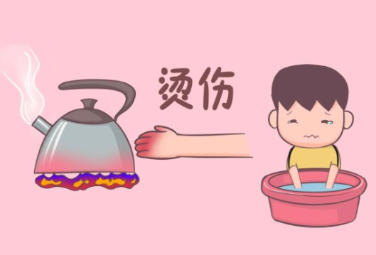 2,中度烫伤