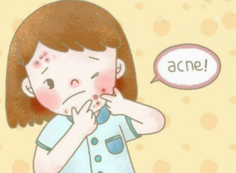 痤疮