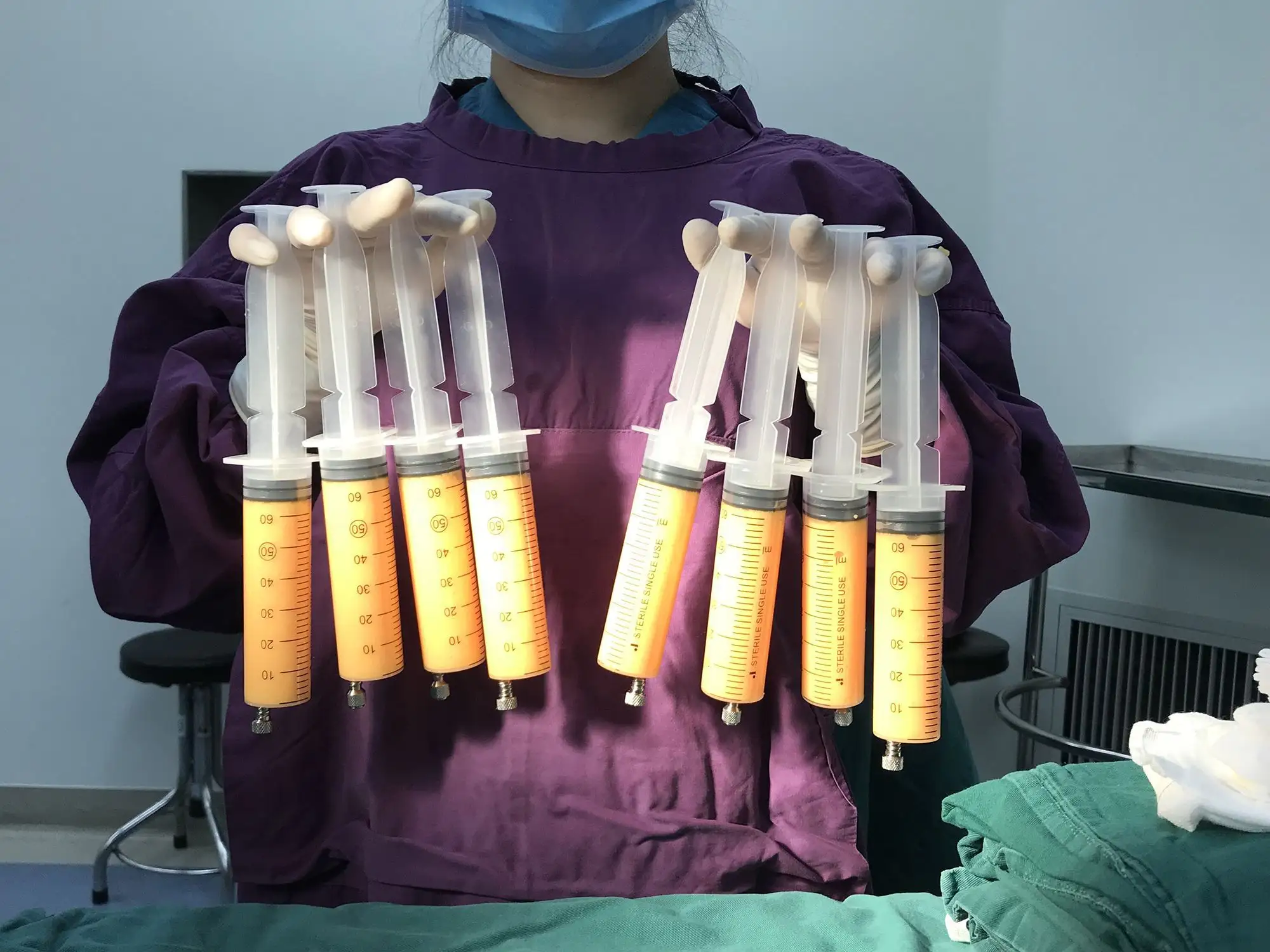 抽脂有什么影响或者副作用吗？