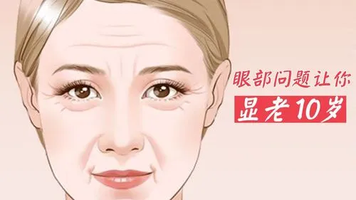 去医院割眼袋大概多少费用？