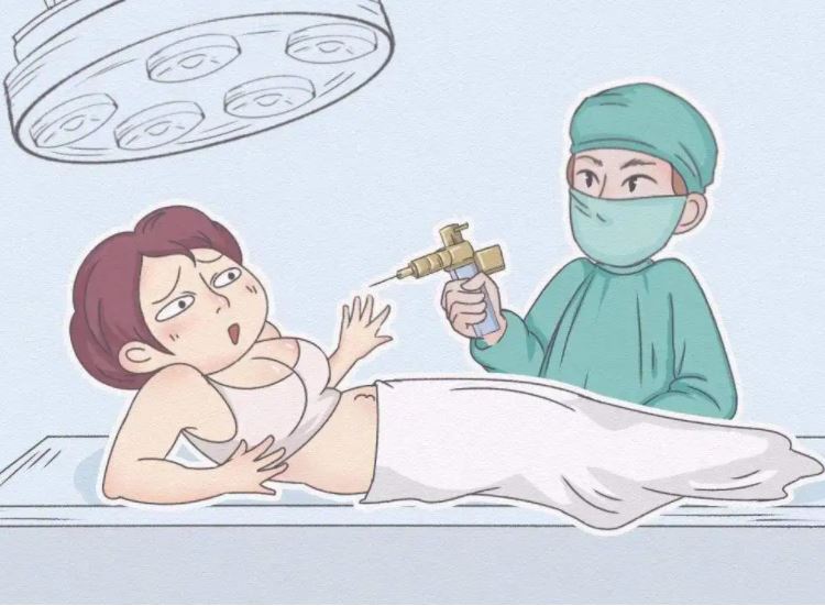 全身抽脂对身体有什么伤害？