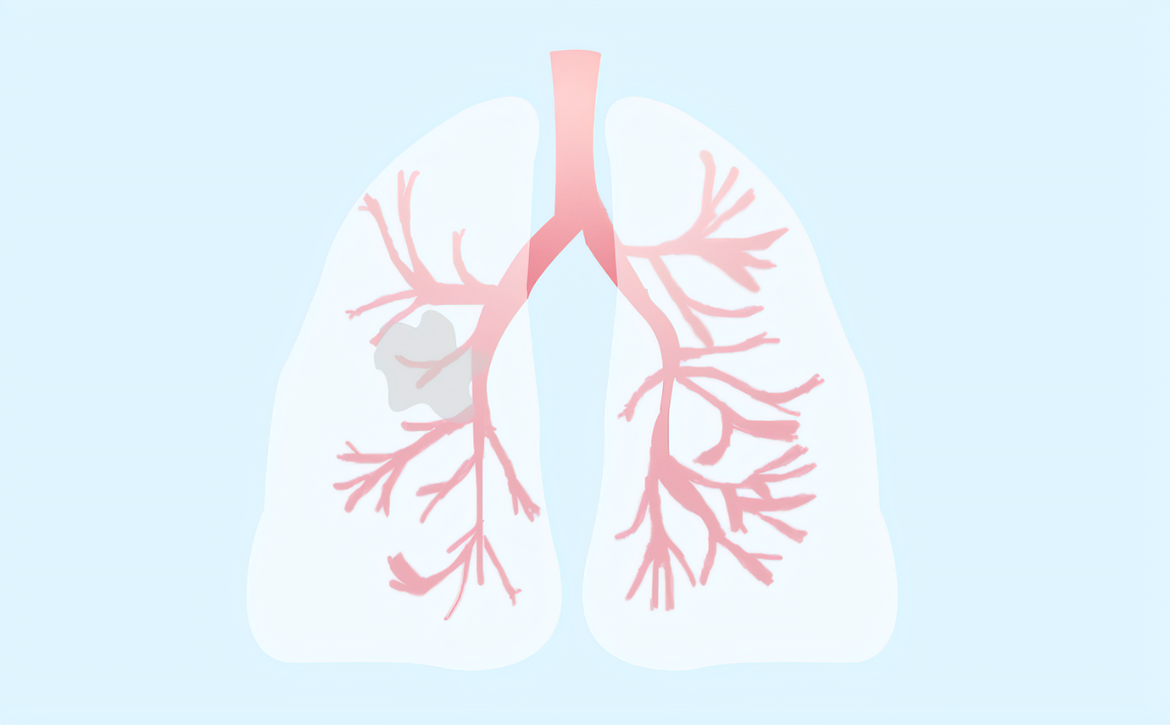 肺结节跟肺结核有什么区别？
